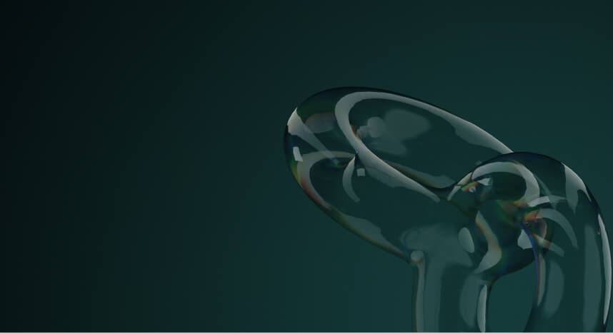 Is Your Cloud a Budget Blackhole? How to Optimize and Save in 2025